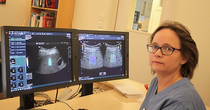 En person sitter framför datorskärmar med ultraljudsbilder på levern